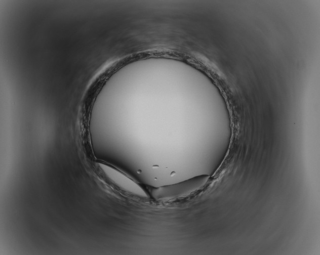 X0000086741400200705111625