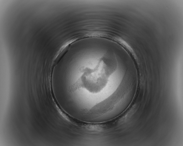 X0000086751041200704201721