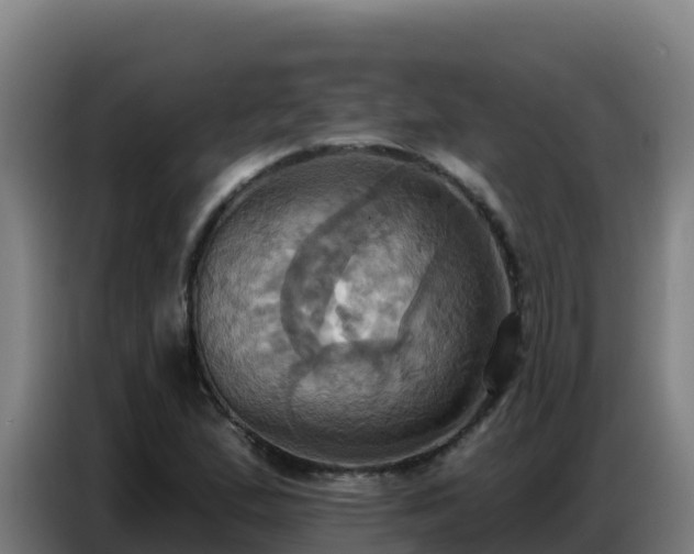 X0000086751167200704201719