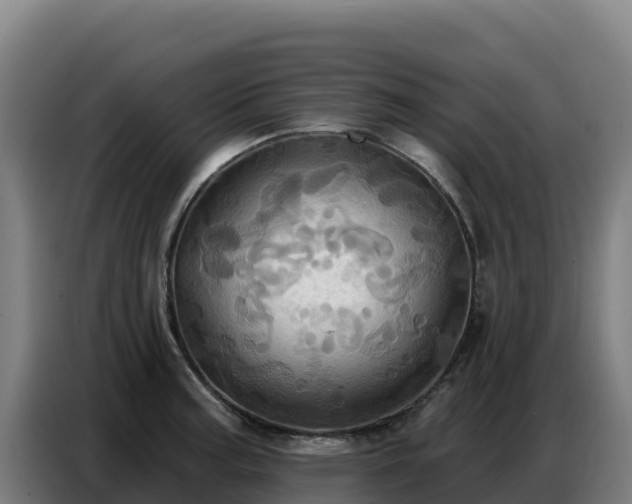 X0000086751187200704201719