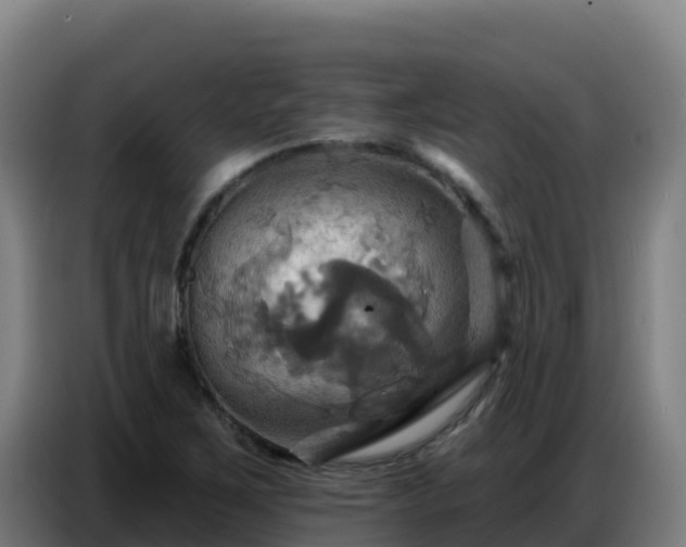 X0000086751267200704201718