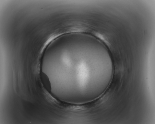 X0000086751459200704201716
