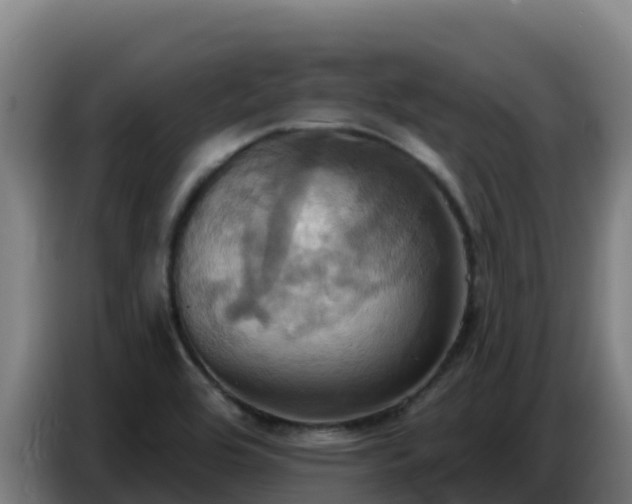 X0000086751464200704201716