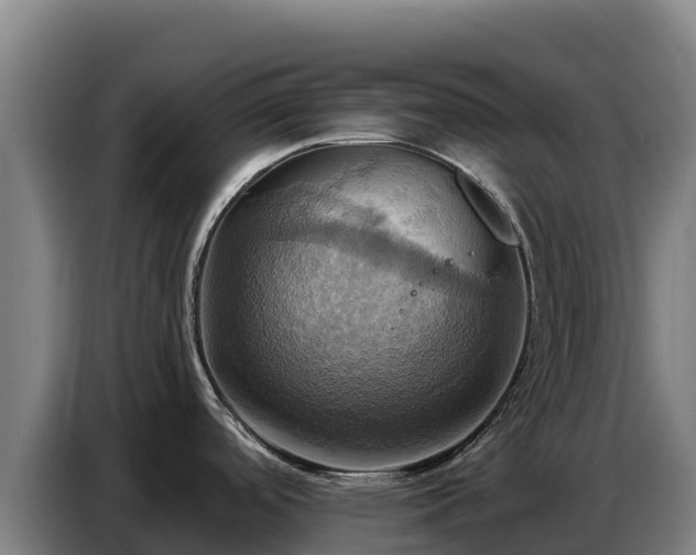 X0000086751488200704201715