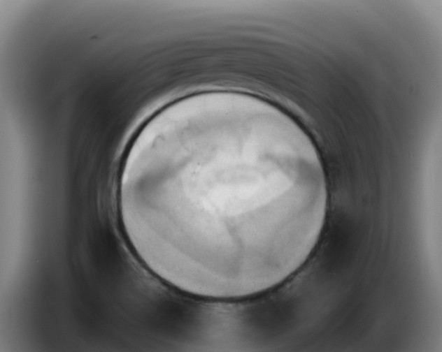 X0000086751514200704201715