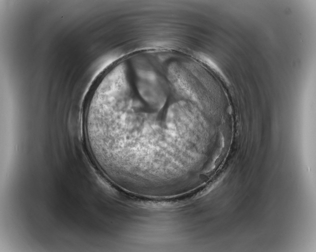 X0000086751079200704271705