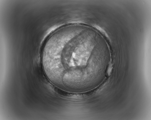 X0000086751167200704271704