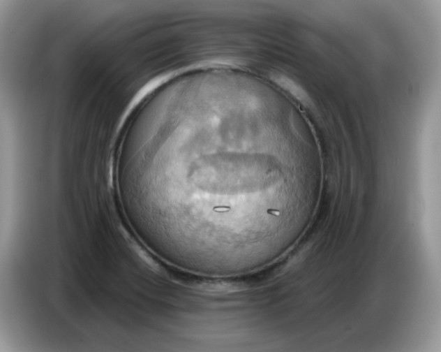 X0000086751420200704271701