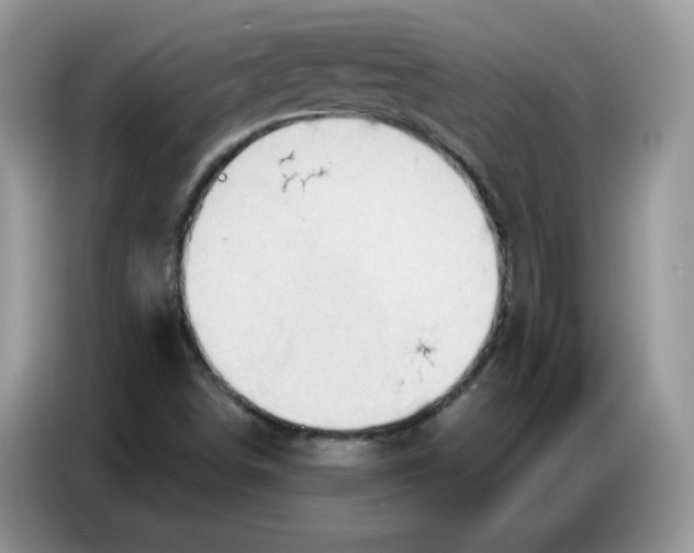 X0000086751498200704271700