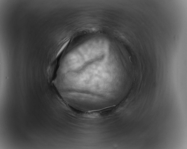 X0000086750576200705041430