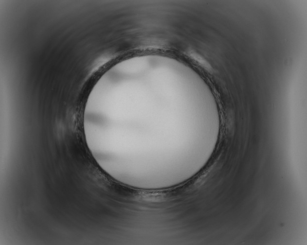 X0000086751258200705041420