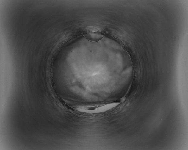 X0000086751393200705041418