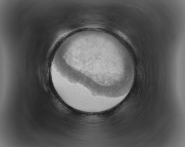 X0000086751408200705041418