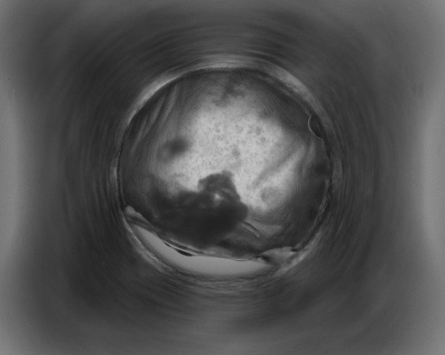 X0000086751417200705041418