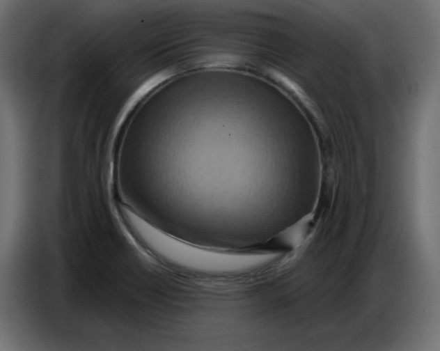 X0000086751418200705041418