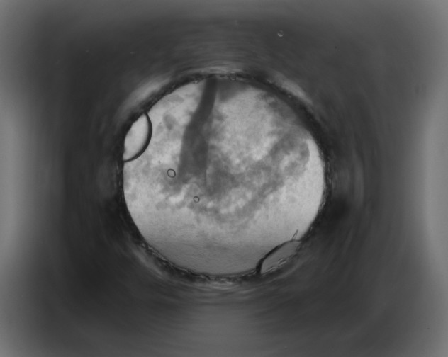 X0000086751448200705041418