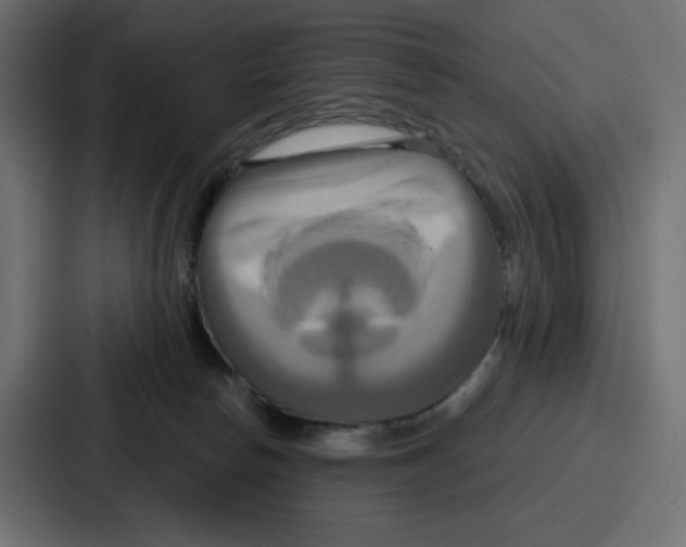 X0000086750178200705111702