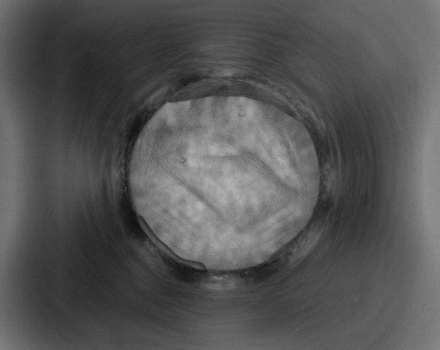 X0000086750376200705111700