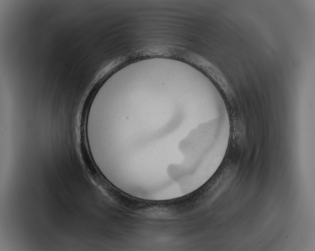 X0000086750578200705111657