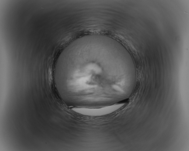 X0000086751106200705111649