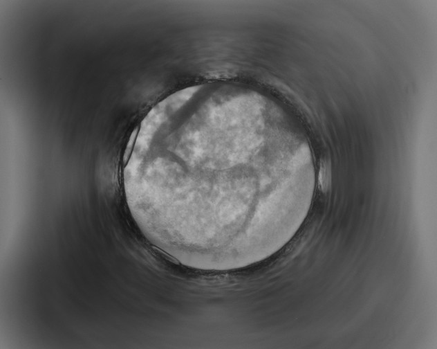 X0000086751444200705111645