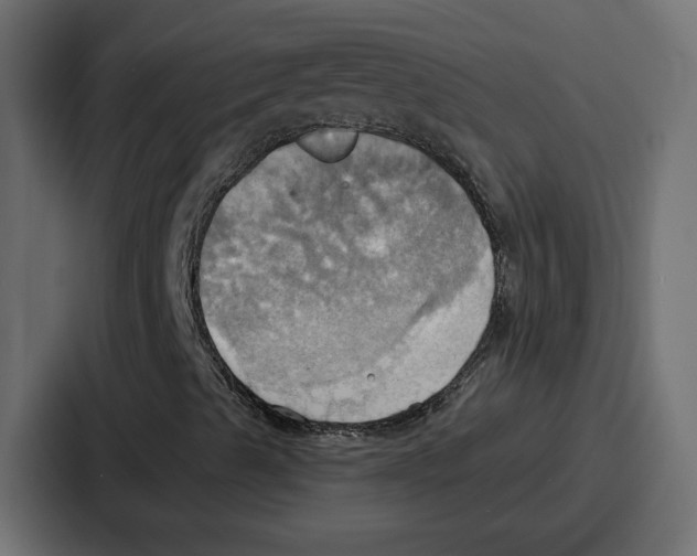 X0000086751489200705111644