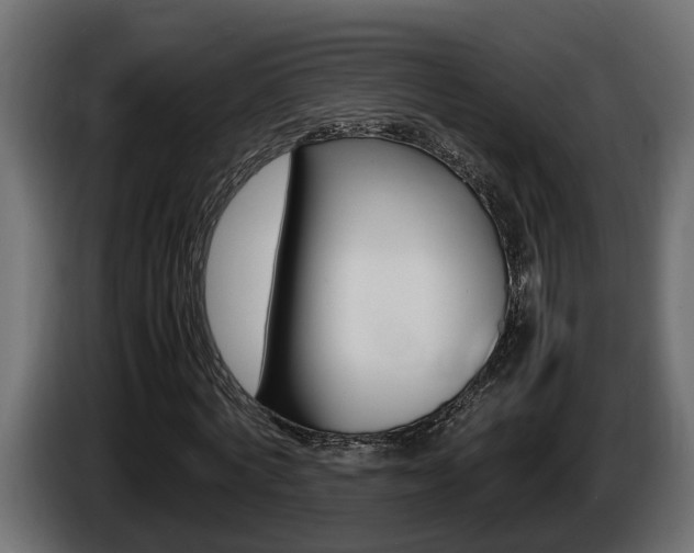 X0000086760772200704130814