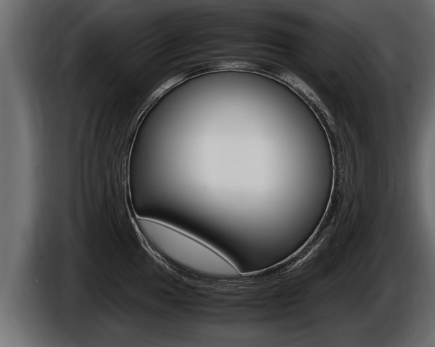X0000086761049200704130810
