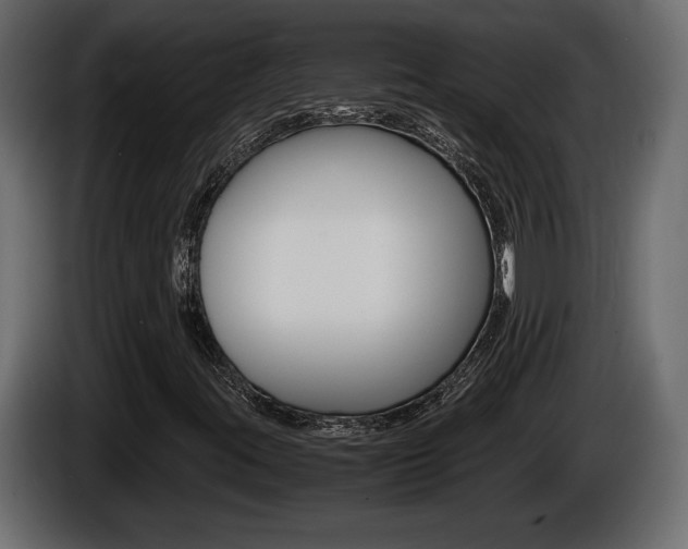 X0000086761395200704130804