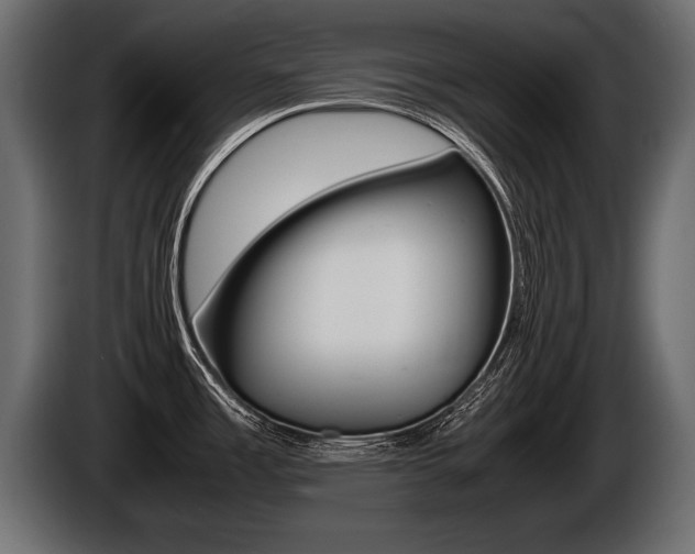 X0000086761485200704130803