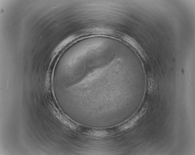 X0000086761074200704131110