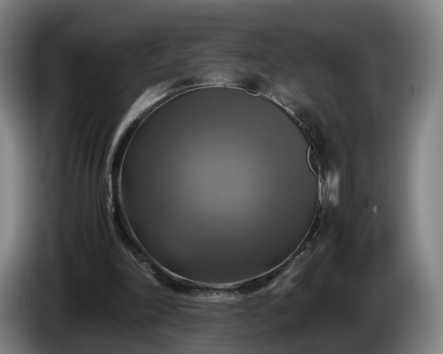 X0000086760198200704201752