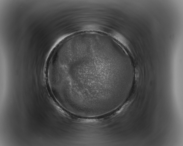 X0000086761068200704201740