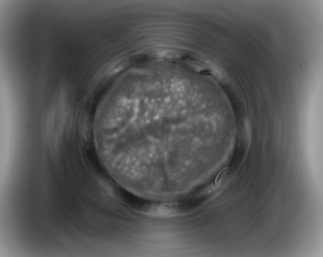 X0000086760078200704271738