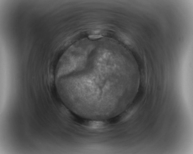 X0000086760085200704271739