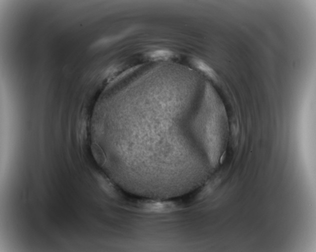 X0000086760379200704271735