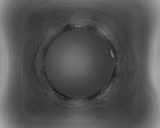 X0000086760817200704271728