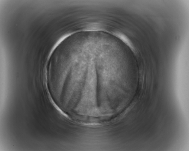 X0000086761476200704271720