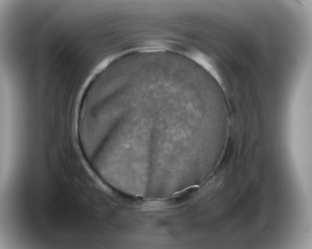 X0000086761477200704271720