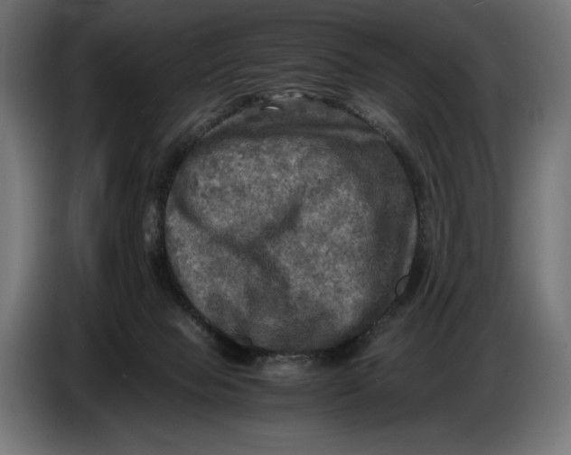 X0000086760077200705041456