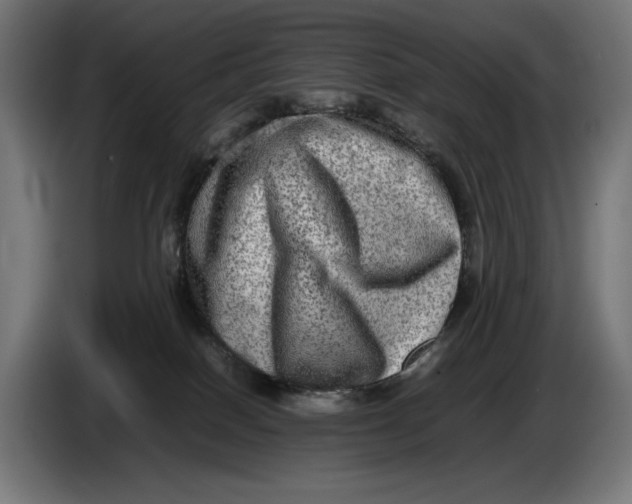 X0000086760086200705041456