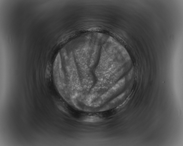 X0000086760175200705041455