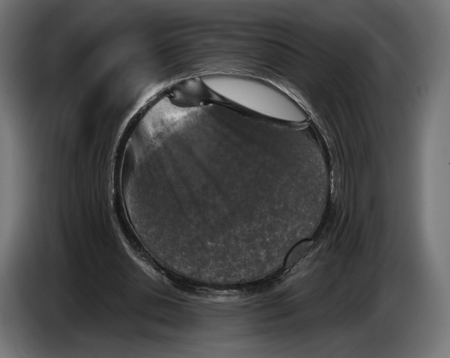 X0000086760438200705041451