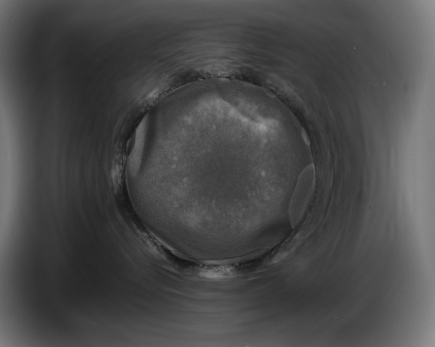 X0000086760576200705041450