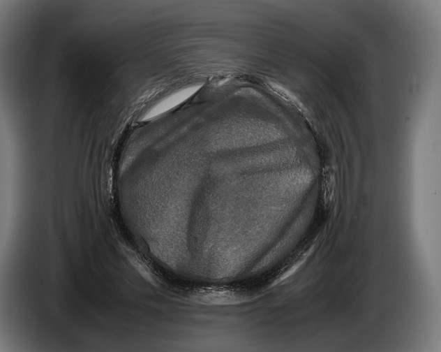 X0000086760589200705041450