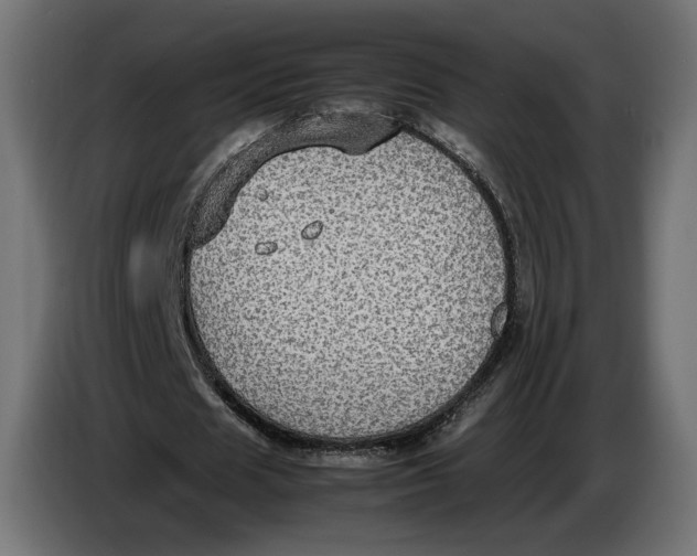 X0000086760625200705041449