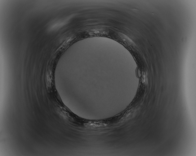 X0000086760915200705041445