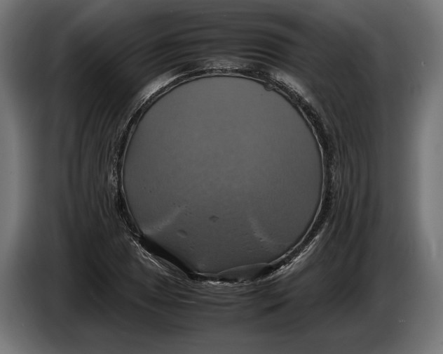 X0000086761025200705041444