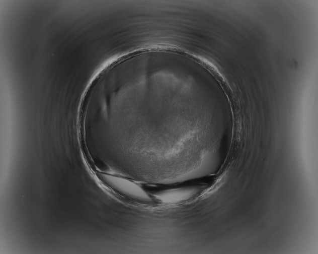 X0000086761038200705041444