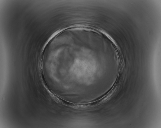 X0000086761101200705041443